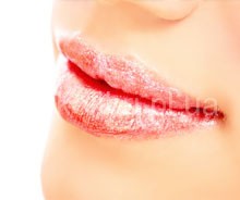 peeling-lips
